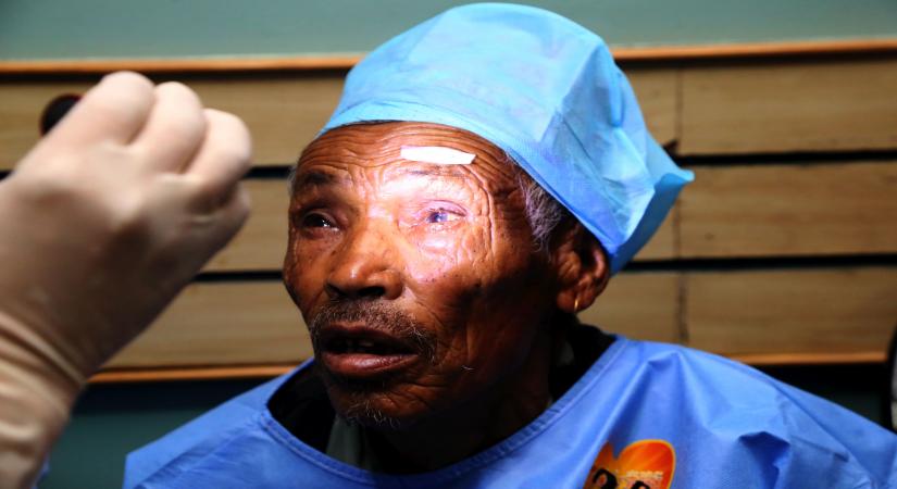 The ability of cataract surgery to restore sight is well known and a new study suggests that it can make people 48 per cent safer on the road. (Xinhua/Sunil Sharma/IANS)