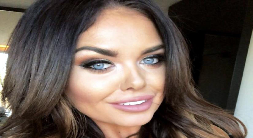 Scarlett Moffatt. (Photo: Twitter/@ScarlettMoffatt)
