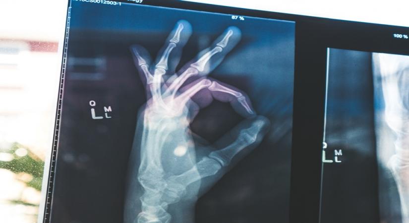 Keeping bones, joints healthy