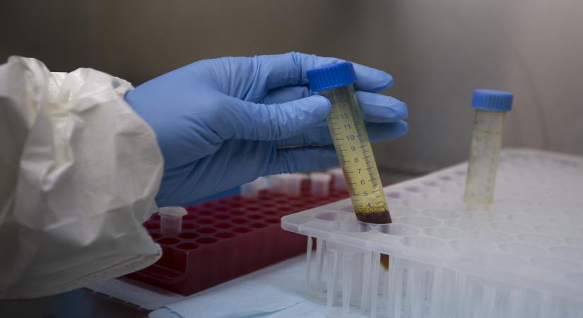 New Delhi, April 11 (IANS) It has been more than three months since Covid-19 pandemic broke out and the hunt for its medicine has been intensified across the globe.