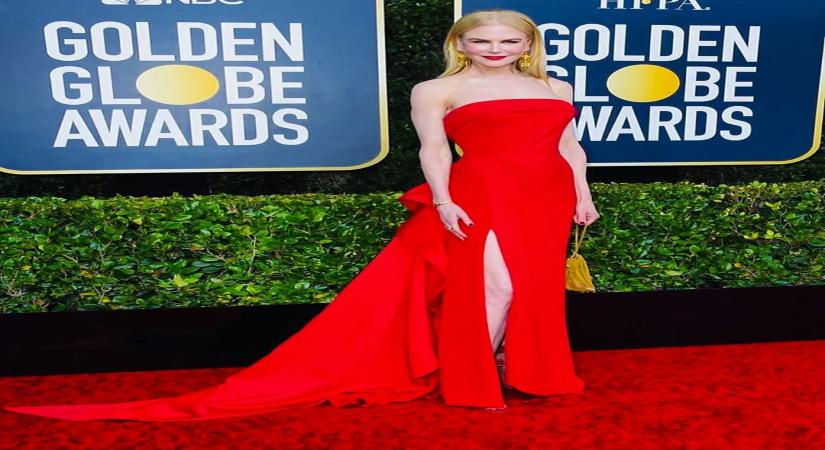 Nicole Kidman.