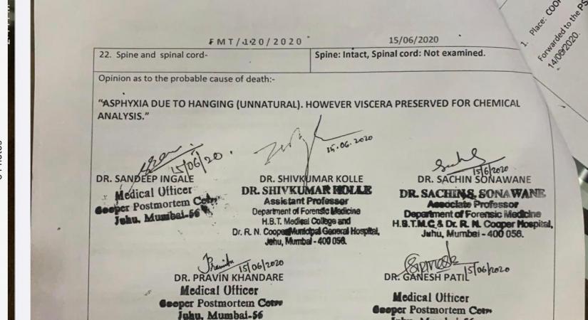 Mystery deepens: Sushant's viscera not preserved properly, hints at 'negligence'.