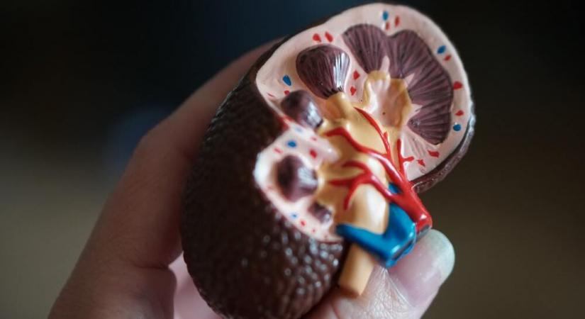 Representative image of a kidney model (Source: Unsplash)