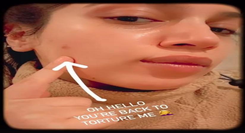 Actress Bhumi Pednekar took to social media on Thursday, to lay bare her pimple woes for fans.