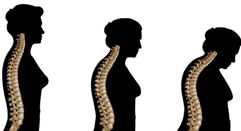 Novel drug form may help treat calcium-related disorders