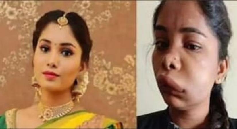 Kannada actress Swathi's face swollen after root canal surgery