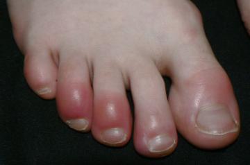 Pic Source: Wikipedia