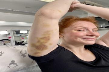 Bryce Dallas Howard bruised while filming 'Jurassic World: Dominion'. (Photo: Sugandha Rawal IANS)