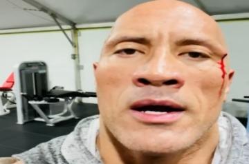 Dwayne Johnson injures face while working out