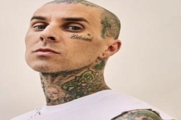 Travis Barker to undergo surgery to repair injured finger